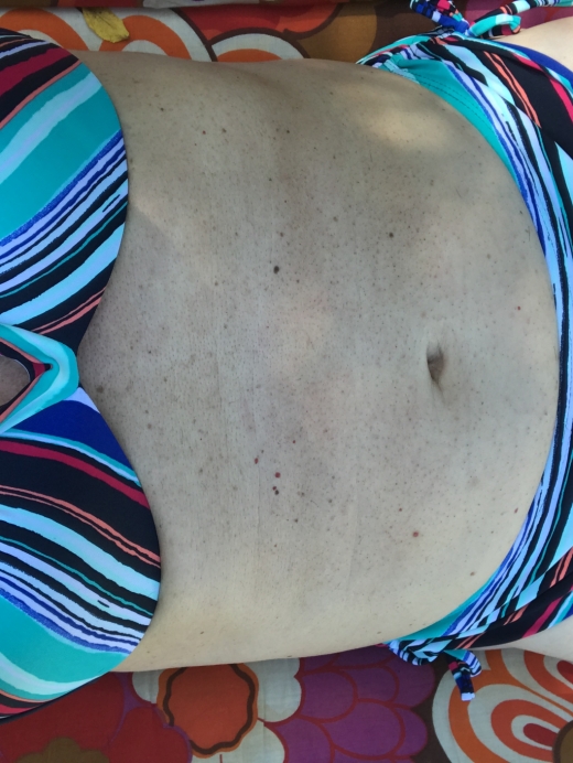 Photo #1