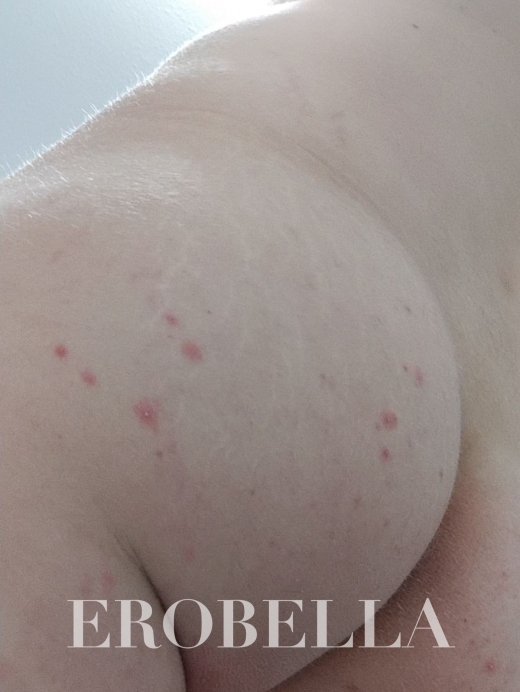 Photo #1